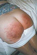 spanked wife displaying her reddened bottom